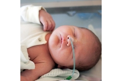 A baby on oxygen