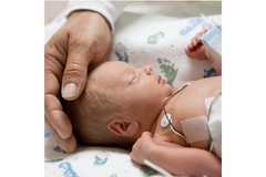 A baby with ECG stickers