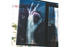 Image bones x ray