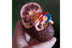 Image Hand holding up model of kidney