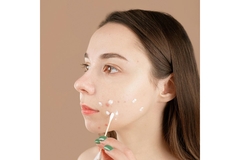 girl with acne on right cheek applies cream on spots