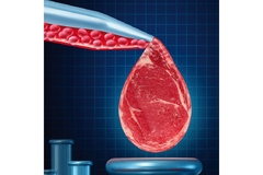 Image A blood transfusion is being shown in the form of meat.