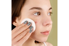 Image A girl holding up a cotton pad up to her cheek.