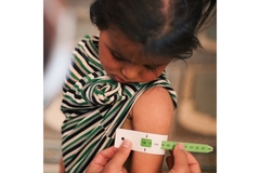 A child gets their arm measured for wasting.