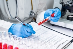 Image Doctor looking at a vile of blood to test iron deficiency.