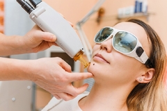 Image Face lasering procedure