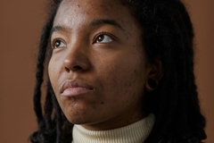 Image Woman with acne and hyperpigmentation looking up to the side