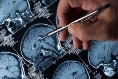 Image An MRI of a brain.