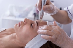 Image A woman getting a laser on her face from a dermatologist.