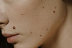 Image Close up of woman's skin