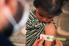 Image Malnutrition was measured using a mid-upper arm circumference belt