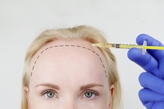 Image woman receiving hair treatment