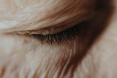 Image skin around eye with wrinkles