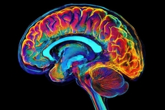 Image colorful xray scan of brain