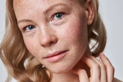 A women's face with freckles.