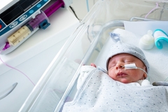 Image Premature baby feeding with a tube