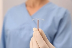 Image A doctor holding a copper IUD.