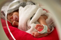 premature baby in an incubator