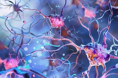 Image Brain amyloid plaques