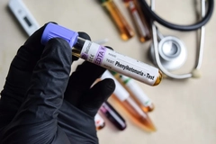 Phenylketonuria test