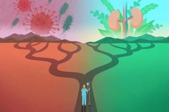 Image Illustration of patient connected to IV drip walking on a path forked to healthy kidneys and bacteria or virus