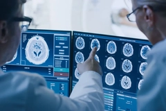 Image A person pointing at a computer screen showing brain conditions