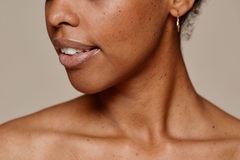 closeup of skin