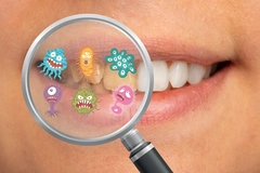 Image Woman's teeth