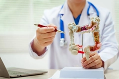 Image doctor talking about colon cancer