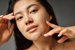 Image A woman with slight acne touching her face.