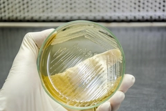 Hand holding petri dish with brewer's yeast