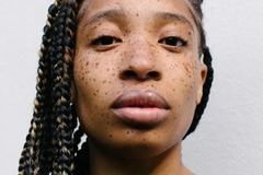 Image Woman with freckles against white backdrop