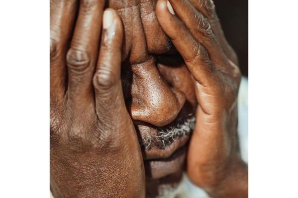 Image Dementia