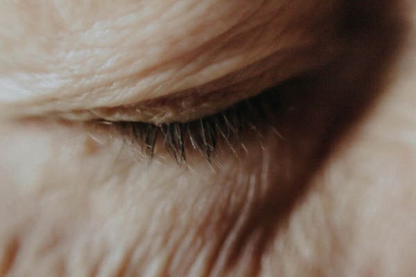 Image skin around eye with wrinkles