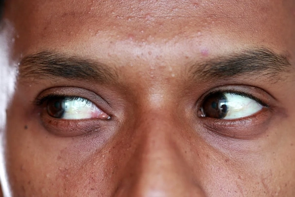 extreme closeup of someones eyes 
